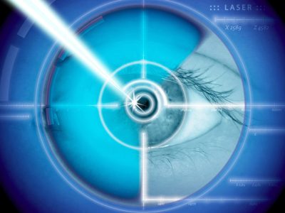 Lasik Co-Management